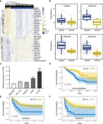 The Novel lncRNA RP9P Promotes Colorectal Cancer Progression by Modulating miR-133a-3p/FOXQ1 Axis